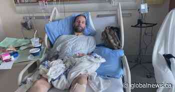 Homeless Calgarian struck in a hit and run and left for dead