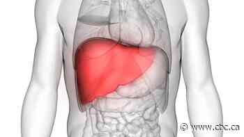 You may not have heard of fatty liver disease. Experts say you need to know