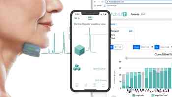 Edmonton company's new technology helps cancer patients who struggle to swallow