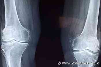 Bone cancer: What are the symptoms, causes and treatments?