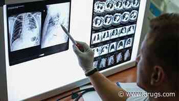 Cancer Risk Increased With Exposure to Four or More CT Scans by Age 18