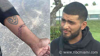 ‘He Just Started Swinging': Man Speaks Out After Getting Stabbed in Little River