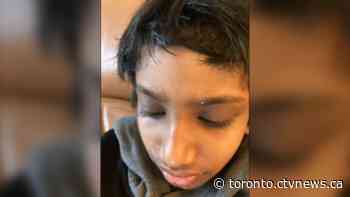 Parents demand answers after elementary school staff cuts hair of child with autism