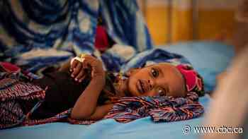 Deadly African drought not possible without climate change, study finds