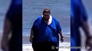 US-Amerikaner nimmt über 150 Kilo ab und leidet – „Schwer, sich ohne Shirt zu zeigen“