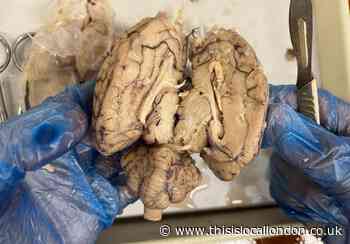 BRAINS by Sayanen Sawmynaden, Tiffin School