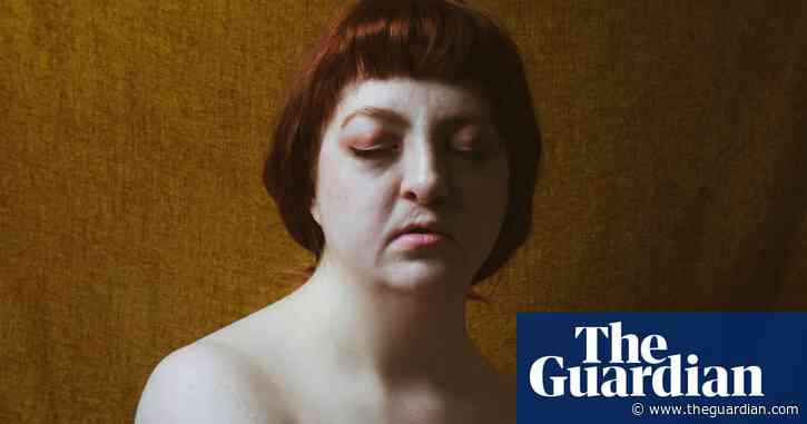 A moment that changed me: I was bullied over my cleft palate – but found confidence as a life model