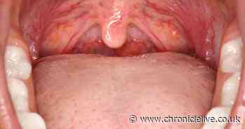 Dry mouth symptom could be 'red flag' for five serious illnesses, warns dental health expert