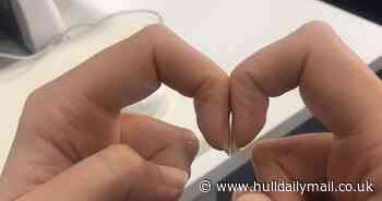 Early sign of lung cancer can be detected by using simple 'finger test' at home