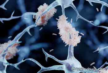 Experimental Drug for Alzheimer Disease Slows Decline in Thinking