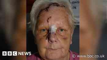 Man whose dog savaged elderly neighbour sentenced