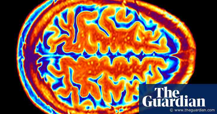 How AI is making non-invasive mind reading a reality – podcast