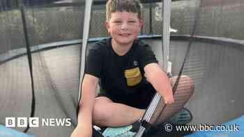 Bude boy to get bionic arm after fundraising campaign
