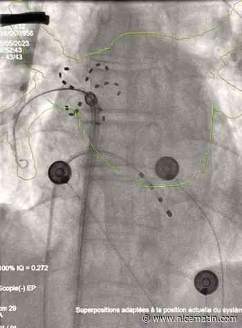 Patients atteints de fibrillation auriculaire paroxystique: une nouvelle énergie pour un traitement plus sûr