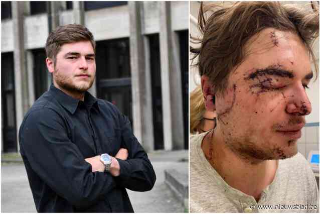 “Modellenwerk mag ik wel vergeten”: Sam (25) levenslang verminkt na laffe aanval met bierglas op Eiermarkt, aanvaller riskeert 40 maanden cel