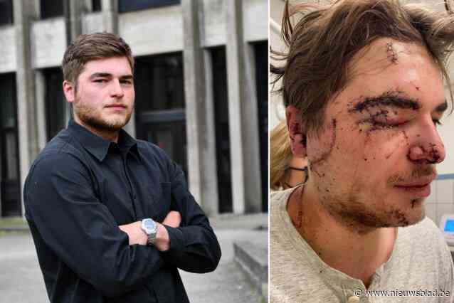 Sam (25) levenslang verminkt na laffe aanval met bierglas: “Modellenwerk mag ik wel vergeten”