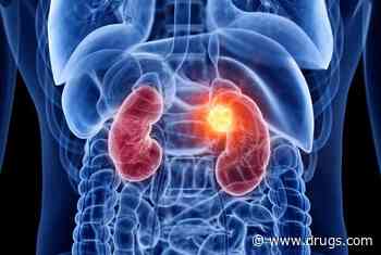 Cabozantinib Plus Nivolumab and Ipilimumab Increases PFS in Renal Cell Cancer