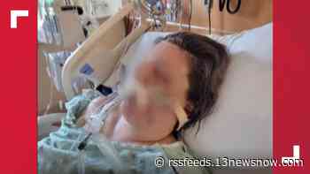 Hampton woman stabbed multiple times in the face speaks out