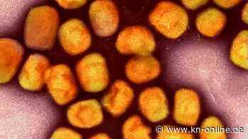 Affenpocken: Laut WHO keine Notlage mehr - wie gefährlich sind sie noch?
