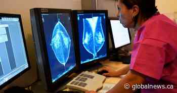 Queen’s University researchers working on cutting-edge breast cancer research