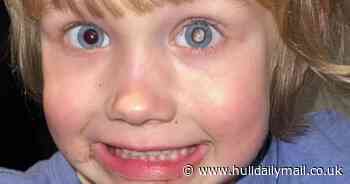 'I thought my son had conjunctivitis - but he's got cancer'