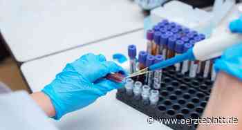 Biomarkertest bei Brustkrebs: G-BA überprüft neue Studienlage