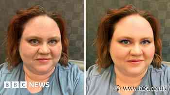 Should social media face-altering filters be regulated?