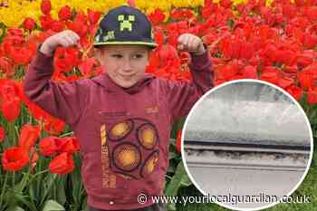 Sutton mum and son with Barth syndrome live with mould in flat