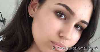 Calls to improve allergy labelling in restaurants after fatal reactions