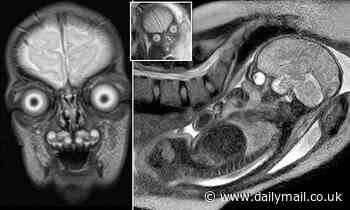 Are these aliens... or human babies? Mind-boggling MRI scans of foetuses are terrifying people