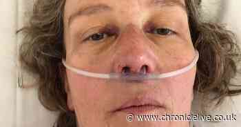 County Durham triathlete suffered serious brain injury after being hit by cyclist