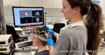 Long Covid: Newcastle University team identify potential key symptoms of fatigue in nervous system