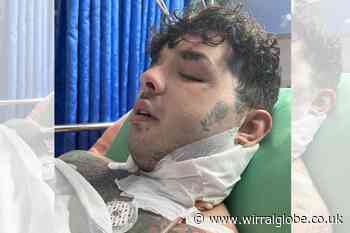 Update on condition of Liam Kilby injured in Thailand