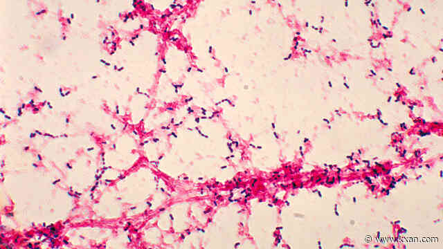 Texas Department of State Health Services issues meningitis warning tied to surgeries performed in Mexico