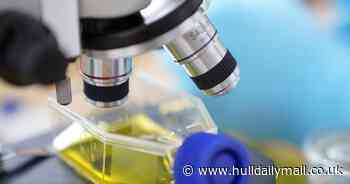 Pancreatic cancer new treatment hope as study reveals it 'changes diet' to keep growing