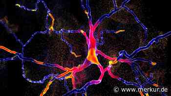 Über 10 Millionen Menschen leiden an Parkinson: Neue Studie findet womöglichen Auslöser der Krankheit