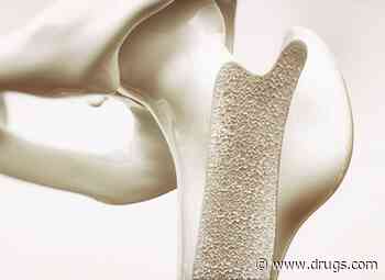 Femoral Neck BMD Lower in Men With Combat-Related Traumatic Injury