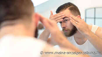 Cholesterinspiegel zu hoch: Veränderungen der Haut im Gesicht deuten auf zu viel Blutfett hin