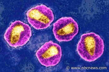 U.S. progress in HIV fight continues to trail many other rich nations