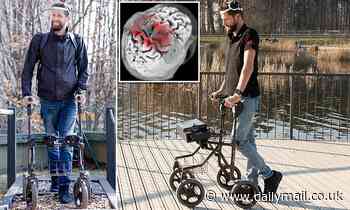 Paralysed man walks for the first time in 12 YEARS after being fitted with an electronic implant
