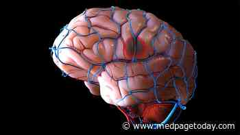 DOACs Safe to Start Soon After Acute Ischemic Stroke