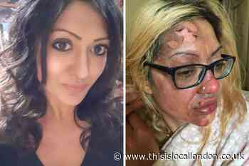 Woman warns others against TikTok microwave egg hack