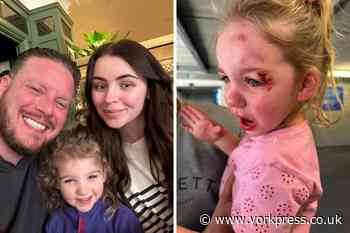 Girl suffers head injury in accident at Little Green Rascals in York