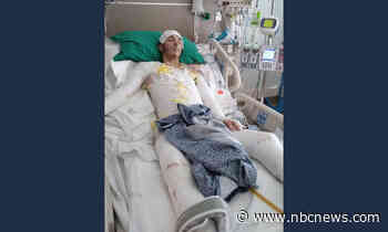 Florida deputy charged after stun gun turned man covered with fuel into 'human fireball'