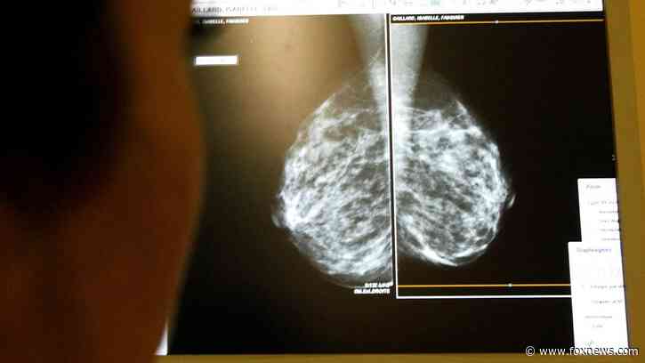 Artificial intelligence model to help scientists predict whether breast cancer will spread