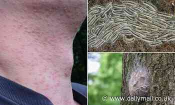 Toxic caterpillars that cause rashes are spreading across England - how to spot them