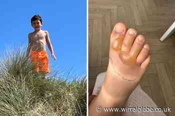 Boy 'sobbed' in pain after incident on Leasowe Beach
