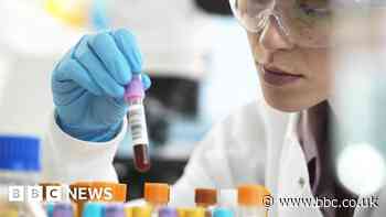 Multi-cancer blood test shows real promise in NHS study