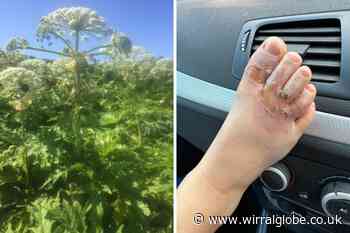 Council says giant hogweed in Leasowe ‘continues to be treated’