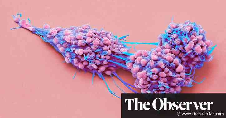 New drug combination offers ovarian cancer breakthrough